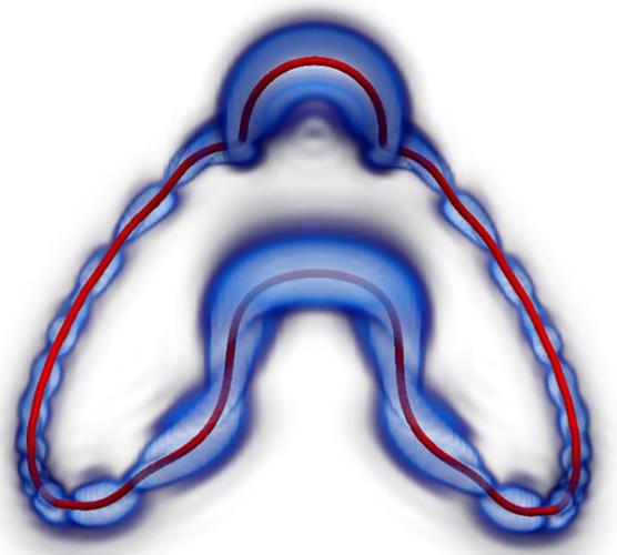 guo simulation of vortex reconnection