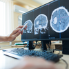 hand points with a pen at a computer monitor displaying multiple cross-section brain CT scans showing a large tumor, diagnostic