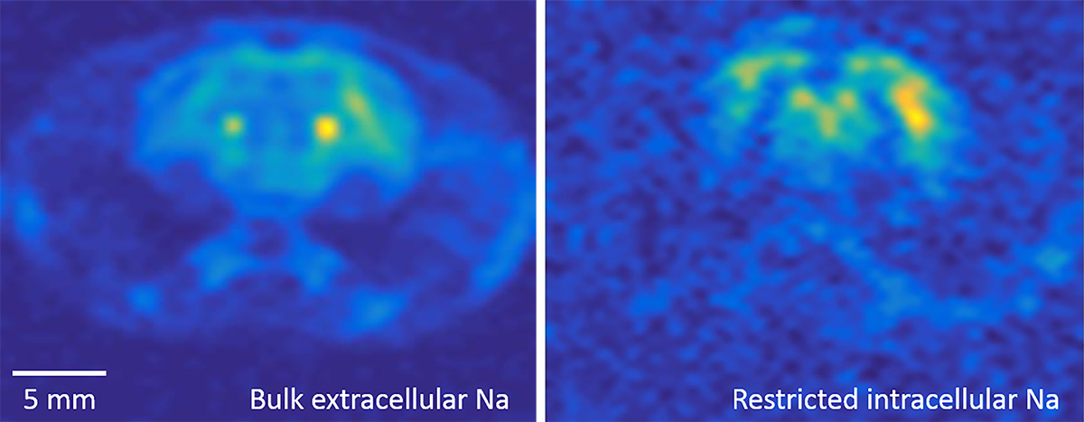 Mostly free extracellular sodium in different sections of the brain